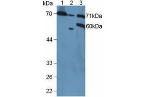 Western blot analysis of (1) Mouse Kidney Tissue, (2) Mouse Placenta Tissue and (3) Human HeLa cells. (VCAM1 anticorps  (AA 109-318))