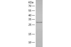 Western Blotting (WB) image for Haptoglobin (HP) (AA 145-405) protein (His-IF2DI Tag) (ABIN7123252)