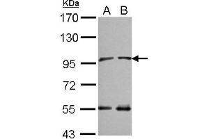 Western Blotting (WB) image for anti-N(alpha)-Acetyltransferase 15, NatA Auxiliary Subunit (NAA15) (C-Term) antibody (ABIN1491819) (NAA15 anticorps  (C-Term))