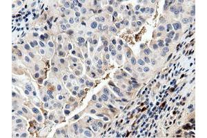 Image no. 9 for anti-5'-Nucleotidase Domain Containing 1 (NT5DC1) antibody (ABIN1499837)