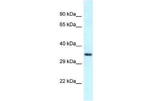 Western Blotting (WB) image for anti-Fibronectin Type III and SPRY Domain Containing 1-Like (FSD1L) (C-Term) antibody (ABIN2788498)