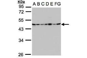 WB Image Sample(30μg whole cell lysate) A: 293T B: A431 , C: H1299 D: HeLa S3 , E: Hep G2 , F: MOLT4 , G: Raji , 10% SDS PAGE antibody diluted at 1:1000 (SUCLG2 anticorps)