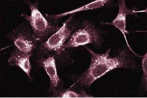 Immunofluorescent staining on Human Endothelial cells. (RAB5 anticorps  (AA 1-215))