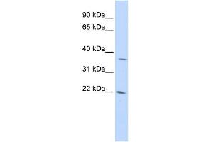 WB Suggested Anti-DDIT4L Antibody Titration: 0.