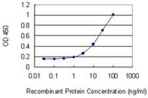 Detection limit for recombinant GST tagged LRRN1 is 0. (LRRN1 anticorps  (AA 1-716))