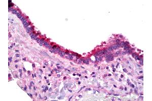 Anti-PTGER1 / EP1 antibody IHC of human lung, respiratory epithelium.