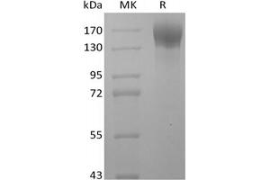 Western Blotting (WB) image for Leptin Receptor (LEPR) protein (Fc Tag) (ABIN7319902)