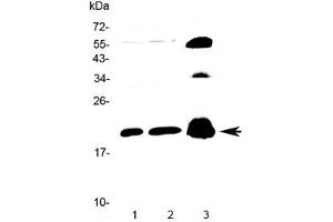 Western blot testing of 1) rat brain, 2) mouse brain and 3) human PANC1 lysate with CPI-17 antibody at 0. (CPI-17 anticorps)