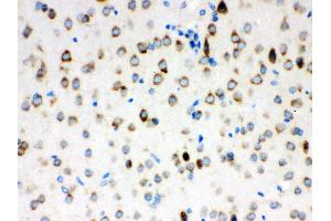 Anti- ATX2 Picoband antibody, IHC(P) IHC(P): Rat Brain Tissue (Ataxin 2 anticorps  (C-Term))