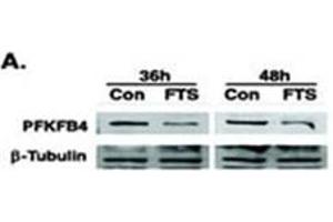 Image no. 2 for anti-6-phosphofructo-2-Kinase/fructose-2,6-Biphosphatase 4 (PFKFB4) (AA 274-303) antibody (ABIN360670) (PFKFB4 anticorps  (AA 274-303))