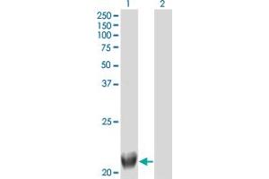 Western Blot analysis of TRIML1 expression in transfected 293T cell line by FLJ36180 monoclonal antibody (M01), clone 4F8. (TRIML1 anticorps  (AA 369-468))