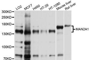 Western blot analysis of extracts of various cell lines, using MAN2A1 antibody. (alpha-Mannosidase II anticorps  (AA 865-1144))