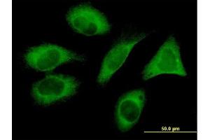 Immunofluorescence of monoclonal antibody to FLJ20643 on HeLa cell. (PIH1D1 anticorps  (AA 1-290))