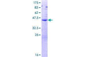 Image no. 1 for Chorionic Gonadotropin, beta Polypeptide 5 (CGB5) (AA 1-165) protein (GST tag) (ABIN1349245)