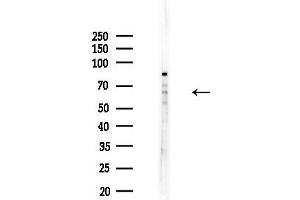 Western blot analysis of lysates from COLO205 cells, using CEACAM20 Antibody at 1/1000 dilution. (CEACAM20 anticorps  (Internal Region))