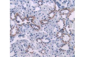 IHC-P analysis of kidney tissue, with DAB staining. (PIM1 anticorps  (AA 38-177))