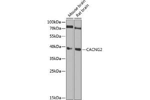 Western blot analysis of extracts of various cell lines, using C Antibody (ABIN6129365, ABIN6137826, ABIN6137828 and ABIN6222199) at 1:1000 dilution.