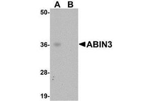 Western blot analysis of ABIN3 in human spleen tissue lysate with AP30005PU-N ABIN3 antibody at 1 μg/ml in (A) the absence and (B) the presence of blocking peptide. (TNIP3 anticorps  (C-Term))