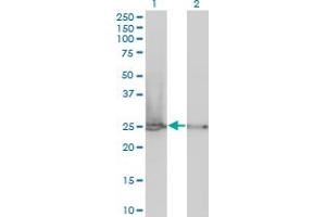 Western Blot analysis of RPL19 expression in transfected 293T cell line by RPL19 monoclonal antibody (M01), clone 3H4. (RPL19 anticorps  (AA 1-100))