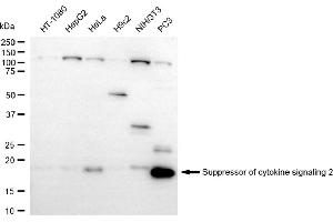 anti-Suppressor of Cytokine Signaling 2 (SOCS2) antibody