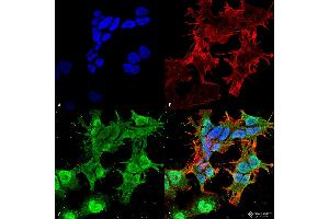 Immunocytochemistry/Immunofluorescence analysis using Mouse Anti-TARP Gamma2/4/8 (Stargazin) Monoclonal Antibody, Clone S245-36 . (Stargazin anticorps  (AA 203-323) (Biotin))