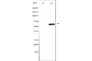 Western blot analysis of IL-10R alpha expression in Na2VO3 treated HepG2 whole cell lysates,The lane on the left is treated with the antigen-specific peptide.
