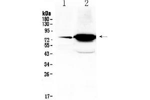 Western blot analysis of FSH Receptor using anti- FSH Receptor antibody . (FSHR anticorps  (Middle Region))