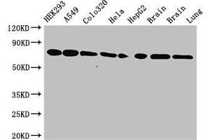 Western Blot Positive WB detected in: HEK293 whole cell lysate, A549 whole cell lysate, Colo320 whole cell lysate, Hela whole cell lysate, HepG2 whole cell lysate, Mouse brain tissue, Rat brain tissue, Rat lung tissue All lanes: HSPA8 antibody at 3.