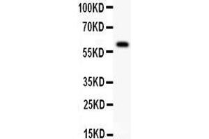 Anti- DR3 antibody, Western blotting All lanes: Anti DR3  at 0. (DR3/LARD anticorps  (N-Term))