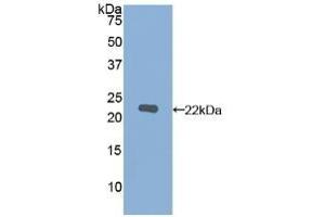 Detection of Recombinant MMP12, Human using Polyclonal Antibody to Matrix Metalloproteinase 12 (MMP12) (MMP12 anticorps  (AA 290-469))