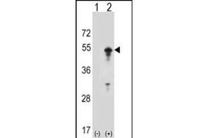 Western blot analysis of ST (arrow) using rabbit polyclonal ST Antibody (D10) (ABIN1882134 and ABIN2839215). (STAM anticorps  (N-Term))