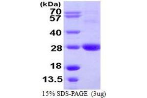 SDS-PAGE (SDS) image for ADP-Ribosylation Factor-Like 11 (ARL11) (AA 1-196) protein (His tag) (ABIN667499)