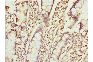Immunohistochemistry of paraffin-embedded human small intestine tissue using ABIN7176126 at dilution of 1:100 (ZNF169 anticorps  (AA 1-85))