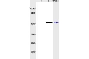 1 rat brain, L2 human colon carcinoma lysates probed (ABIN723935) at 1:200 in 4 °C.