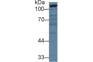 Detection of PC in Porcine Liver lysate using Polyclonal Antibody to Pyruvate Carboxylase (PC) (PC anticorps  (AA 36-486))