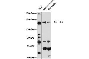 Western blot analysis of extracts of various cell lines, using SLITRK6 antibody (ABIN6130698, ABIN6148072, ABIN6148073 and ABIN6220277) at 1:1000 dilution.