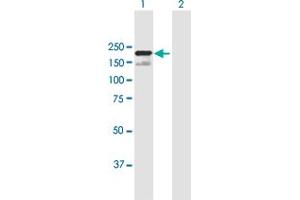 Western Blot analysis of SCAPER expression in transfected 293T cell line by SCAPER MaxPab polyclonal antibody.