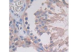 Used in DAB staining on fromalin fixed paraffin- embedded Kidney tissue (TUBE1 anticorps  (AA 225-472))