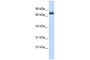 WB Suggested Anti-ASH2L Antibody Titration:  0. (ASH2L anticorps  (Middle Region))
