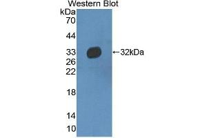 Western Blotting (WB) image for anti-Haptoglobin Related Protein (HPR) (AA 102-347) antibody (ABIN3205656) (HPR anticorps  (AA 102-347))
