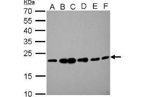 WB Image RAMP2 antibody detects RAMP2 protein by Western blot analysis. (RAMP2 anticorps  (C-Term))