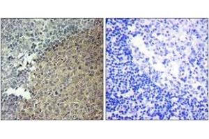 Immunohistochemistry analysis of paraffin-embedded human tonsil tissue, using BLNK (Ab-96) Antibody. (B-Cell Linker anticorps  (AA 62-111))