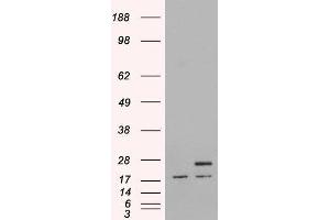 HEK293 overexpressing Human PGRMC1 and probed with ABIN2564496 (mock transfection in first lane). (PGRMC1 anticorps  (C-Term))