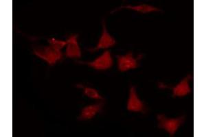 ABIN6267284 staining MDA-MB-231 by IF/ICC.