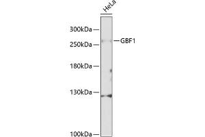 Western blot analysis of extracts of HeLa cells, using GBF1 Antibody (ABIN6132031, ABIN6140994, ABIN6140996 and ABIN6216201) at 1:1000 dilution. (GBF1 anticorps  (AA 1-85))