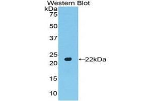 Western Blotting (WB) image for anti-POTE Ankyrin Domain Family, Member G (POTEG) (AA 146-306) antibody (ABIN1171743)