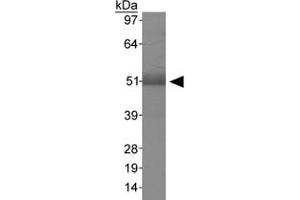 Western blot analysis of MSR1 in human liver using MSR1 polyclonal antibody . (Macrophage Scavenger Receptor 1 anticorps  (AA 300-400))