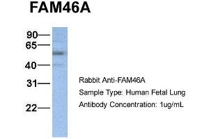 Host:  Rabbit  Target Name:  FAM46A  Sample Type:  Human Fetal Lung  Antibody Dilution:  1. (FAM46A anticorps  (N-Term))