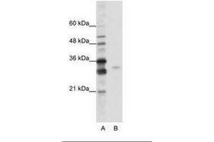 Image no. 1 for anti-serine/arginine-Rich Splicing Factor 1 (SRSF1) (AA 161-210) antibody (ABIN6736207)