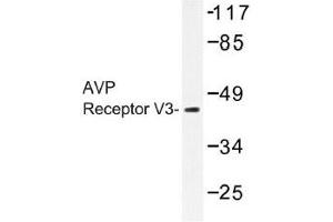 Image no. 1 for anti-Arginine Vasopressin Receptor 1B (AVPR1B) antibody (ABIN317776) (AVPR1B anticorps)